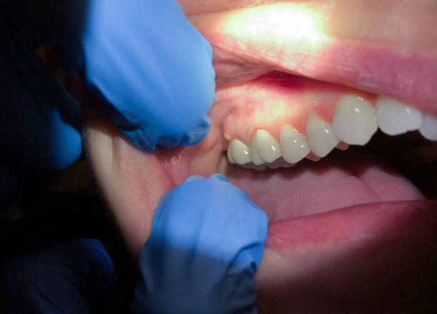 Best Emergency Gum Pain Relief  in Westover, AL