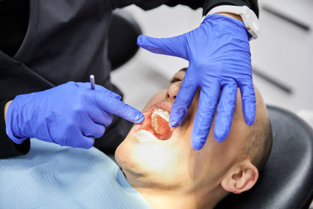 Best Emergency Dental Filling Replacement  in Westover, AL