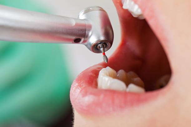 Best Tooth Infection Emergency Dentist  in Westover, AL